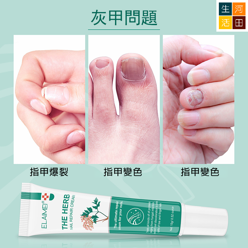 ELAIMEI草本指甲修護霜 腳趾手指灰甲 修復膏