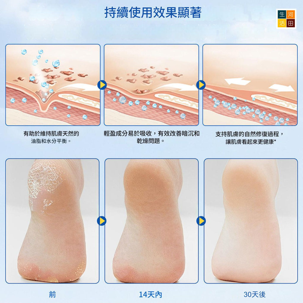 Elaimei 尿素足部護理棒(40G)│軟化角質│去死皮│修護足部│乾裂滋潤膏