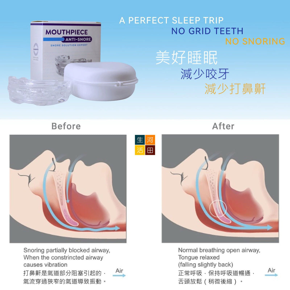齒輪可調式多用途牙套│睡眠牙膠│可調式鼻鼾牙套│改善磨牙牙膠