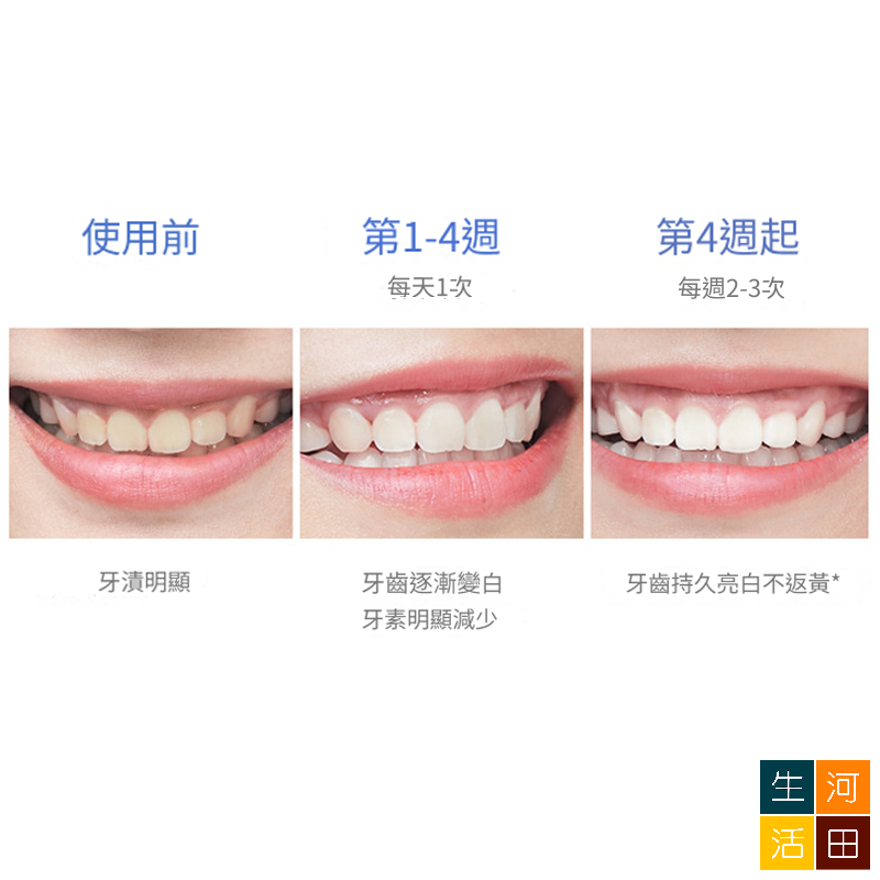 IVISMILE 活性碳淨白牙貼 去黃去漬牙齒美白貼 牙齒炫白條 牙齒護理 (7對14片)