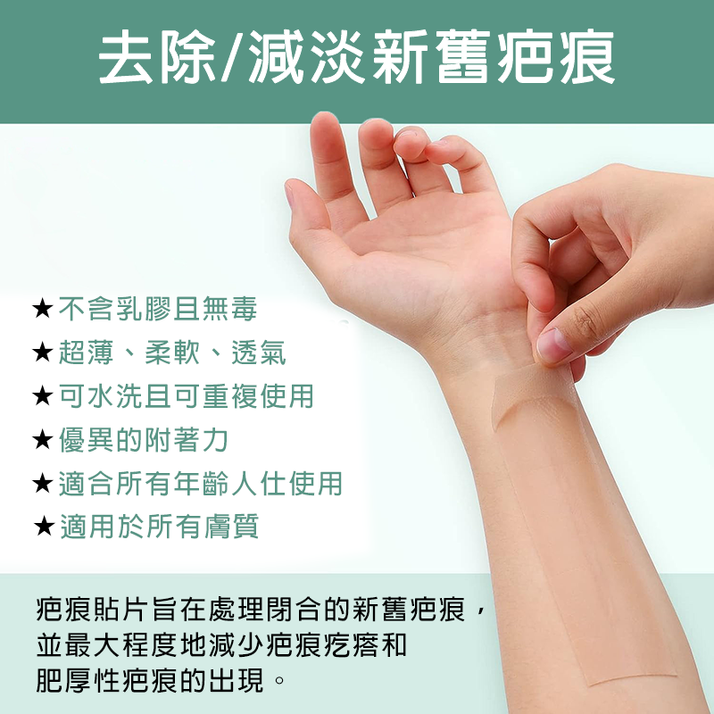 矽膠去疤修復貼 自粘疤痕膠帶 傷口隱形貼 淡化除手術疤痕、剖腹產傷疤等 (4cm x 1.5m)