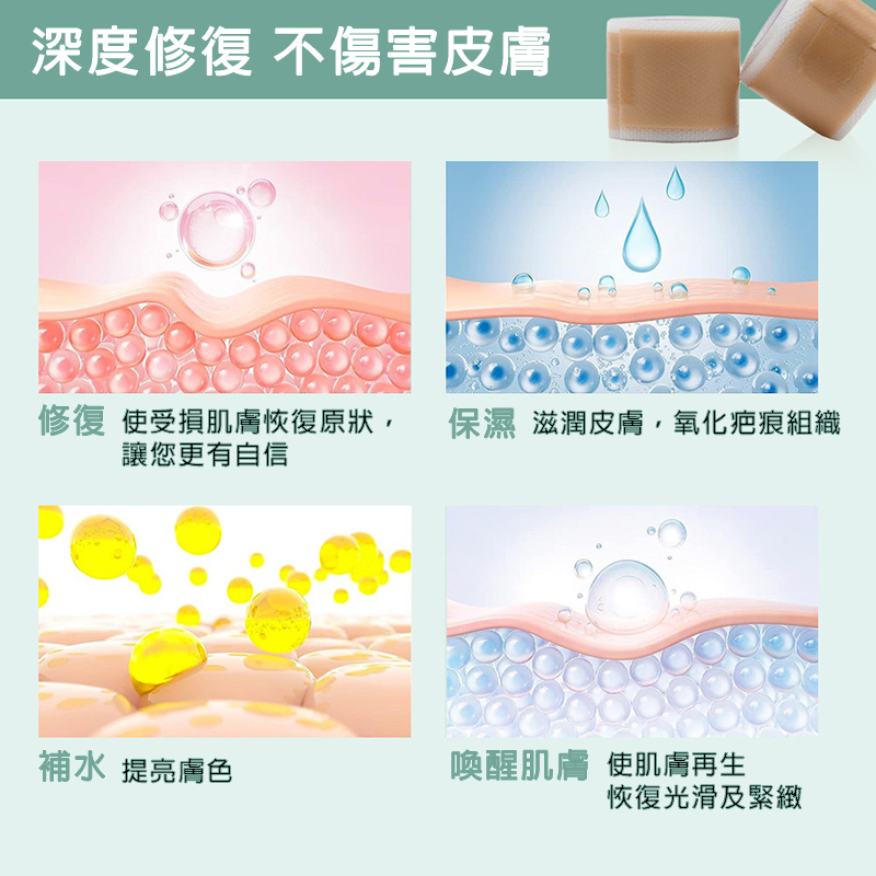 矽膠去疤修復貼 自粘疤痕膠帶 傷口隱形貼 淡化除手術疤痕、剖腹產傷疤等 (4cm x 1.5m)