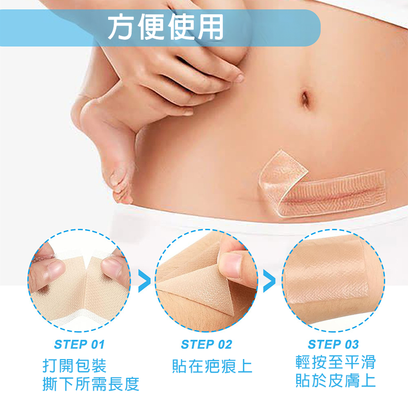 矽膠去疤修復貼 自粘疤痕膠帶 傷口隱形貼 淡化除手術疤痕、剖腹產傷疤等 (4cm x 1.5m)