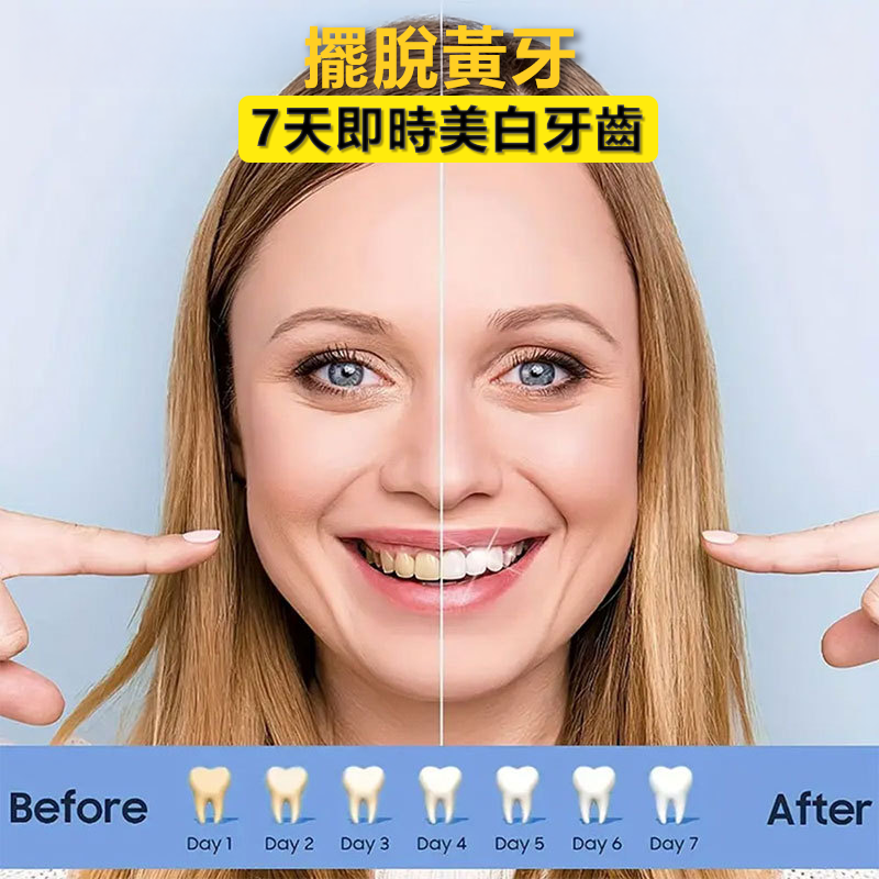 14天美白牙貼 低敏感牙齒美白劑 極速去黃去牙齒漬 (14對28片)