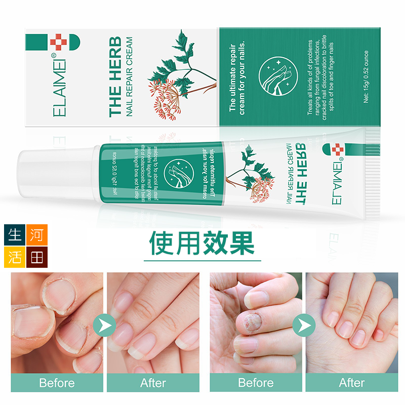ELAIMEI草本指甲修護霜 腳趾手指灰甲 修復膏