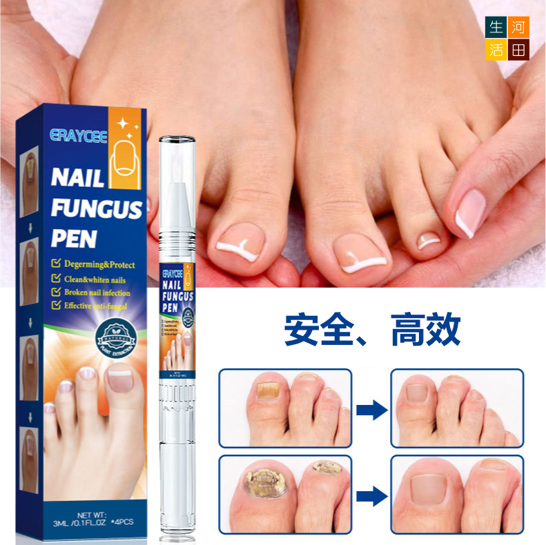 灰甲護理液 一盒4枝*3ml 灰甲筆 腳甲美甲精華液