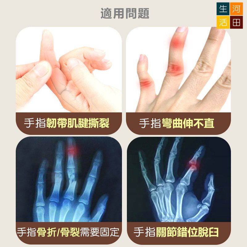 手指夾板腱鞘康復護具(四指款) | 左右通用拇指矯正套| 手指固定保護器