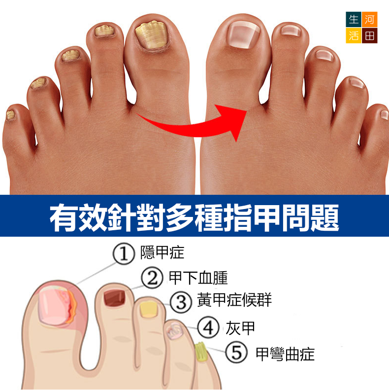 灰甲護理液 一盒4枝*3ml 灰甲筆 腳甲美甲精華液