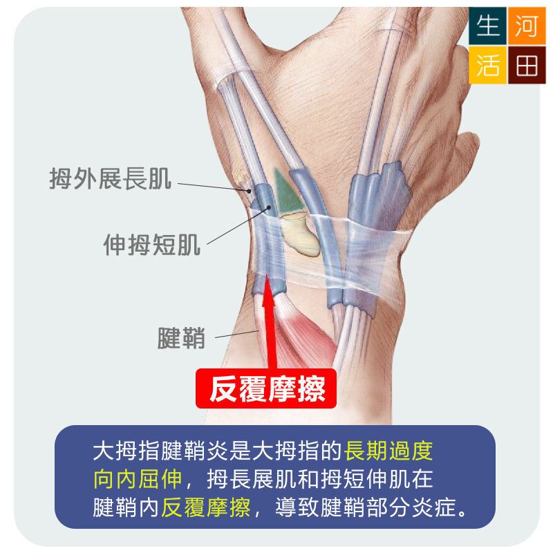 超薄拇指護套左右通用 腱鞘關節護腕 大拇指矯正固定保護帶  彈弓手舒緩帶